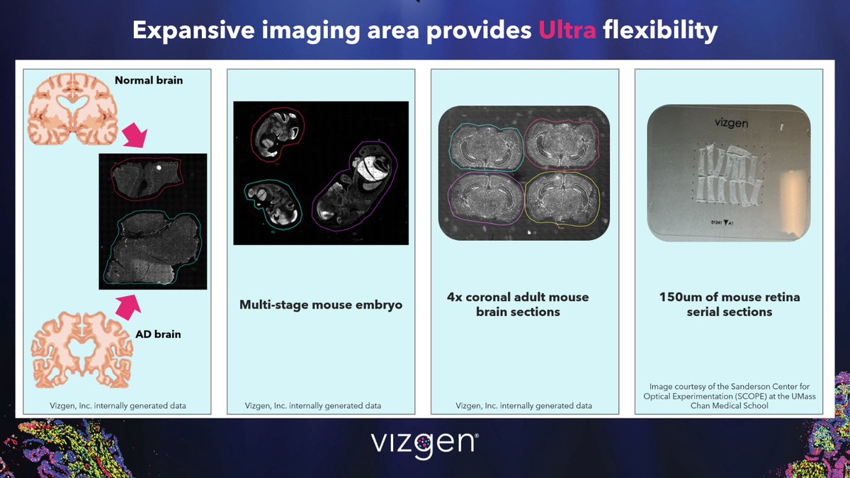 🔬 Expanding the Limits of Discovery with MERSCOPE Ultra™ 🔬

With an expansive 3 cm² imaging area, easily image normal &amp; diseased tissues, multistage embryos, or serial tissue sections in a single run. Eliminate batch effects &amp; experimental variation!
🔗 hubs.ly/Q02Z87cy0
