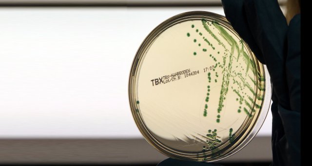 Dt_Aerzteblatt's tweet image. ECDC warnt vor Carbapenem-resistenten E. coli:  Stockholm – Im Europäischen Wirtschaftsraum (EU/EEA) breiten sich derzeit multiresistente Enterobakterien aus, die auch auf Carbapeneme, die zu den letzten effektiven… dlvr.it/TGS0Kz #ecdc #ecoli #antibiotikaresistenz