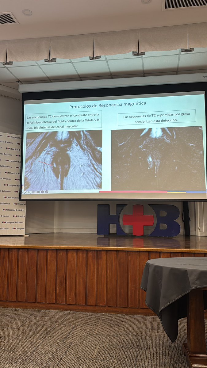 MRI in #IBD course <a href="/coloproctobrit/">Colorectal HB <a href="/Htal_Britanico/">Hospital Británico</a></a> @Htal_Britanico <a href="/MarianoCillo/">MarianoCillo</a> <a href="/adrigarcia09/">Adriana Garcia</a> <a href="/fabioteixeira22/">Fabio Teixeira</a> <a href="/ashtrida/">Astrid Rausch</a> <a href="/IgnacioZubiaurr/">Ignacio Zubiaurre</a> <a href="/nlavellaneda/">Nicolas Avellaneda</a> <a href="/TechColoproctol/">Techniques in Coloproctology Journal</a> <a href="/DCRjournal/">DCRjournal</a> <a href="/escp_tweets/">European Society of Coloproctology</a>