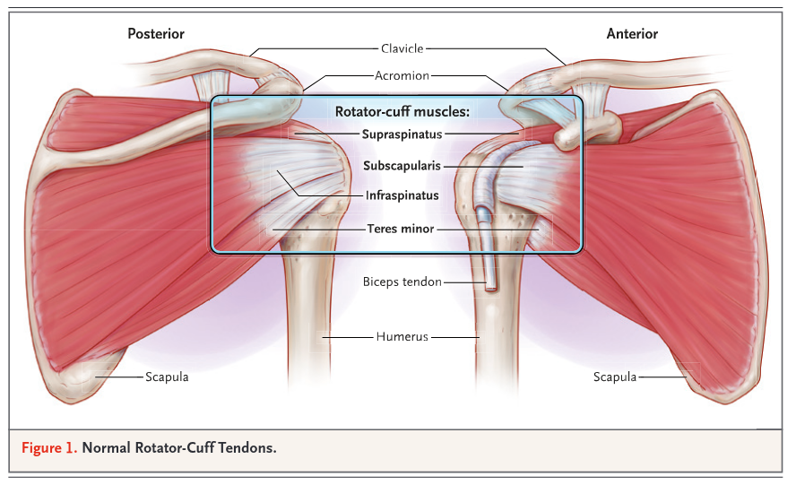 MHcsba's tweet photo. New England Journal of Medicine (NEJM) 2024: Trastornos del manguito rotador
#MedEd #MedX #MedTwitter 
DOI:10.1056/NEJMcp1909797 https://t.co/WL0jlxg7Ka
