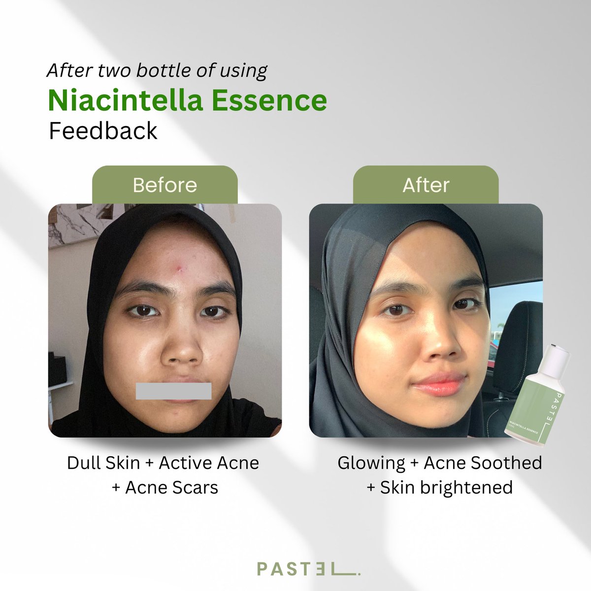 Two bottles = a skin story worth sharing ✨
 From acne and dullness skin to flawless skin, #NiacintellaEssence is here to transform your skin for the better. 💚

Your skin-saviour is almost here! Stay tuned Pastellians 💚🕊️

#PastelSkincare #skinbesT