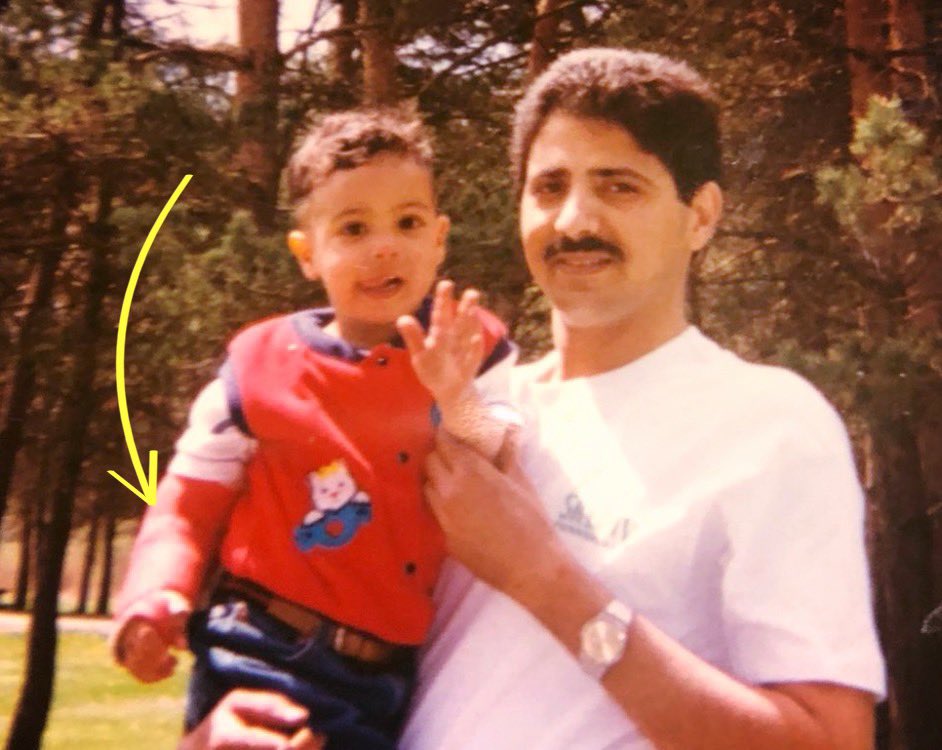 ماشاء الله لاقوة إلا بالله:
كُسِرت يده عندما كان ذو العامين ونصف فكُسرت قلوبنا معها، وفي هذا اليوم السعيد،شاء الله أن يجبر قلوبنا ويخفف آلامنا ويحقق آمالنا ويحصل صديقي الوفي <a href="/ahmed_alalam/">احمد بن محمد العَلم</a> على الدكتوراة في جراحة العظام.
أهنئك على إنجازك المميز الذي توجت به مسيرة تفوق بدأتها في