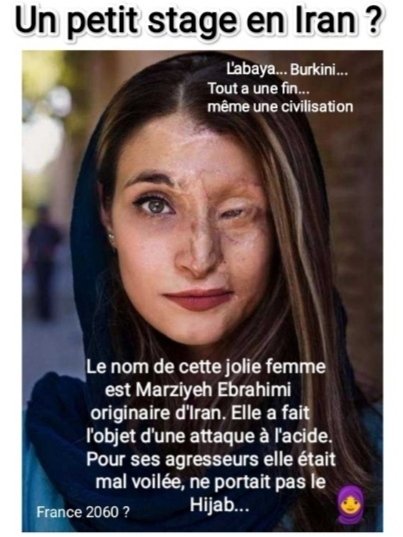YYYZZZ814997's tweet photo. @Guillaume_Bigot https://t.co/frCH8f74yh