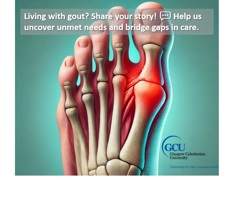 MSK Health GCU (@mskhealthgcu) on Twitter photo 🧬💬 Got gout? Share your insights to help us improve gout management in Scotland! 📞 Join a short phone chat + review docs = £25/hr thank you payment. Help from home! 🙌 DM or email gordon.hendry@gcu.ac.uk to take part. #GoutResearch #Scotland 🩺📚 🧬💬 Got gout? Share your insights to help us improve gout management in Scotland! 📞 Join a short phone chat + review docs = £25/hr thank you payment. Help from home! 🙌 DM or email gordon.hendry@gcu.ac.uk to take part. #GoutResearch #Scotland 🩺📚