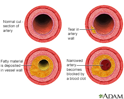 madelpozo67's tweet photo. Nobody is happy about their fat depots expanding but, actually, the adipocyte is the safest place to store excess energy. Adipocytes hoard lipids so they don’t accumulate in the liver or the arteries, where they could cause harm. https://t.co/W6aiAt16Fx