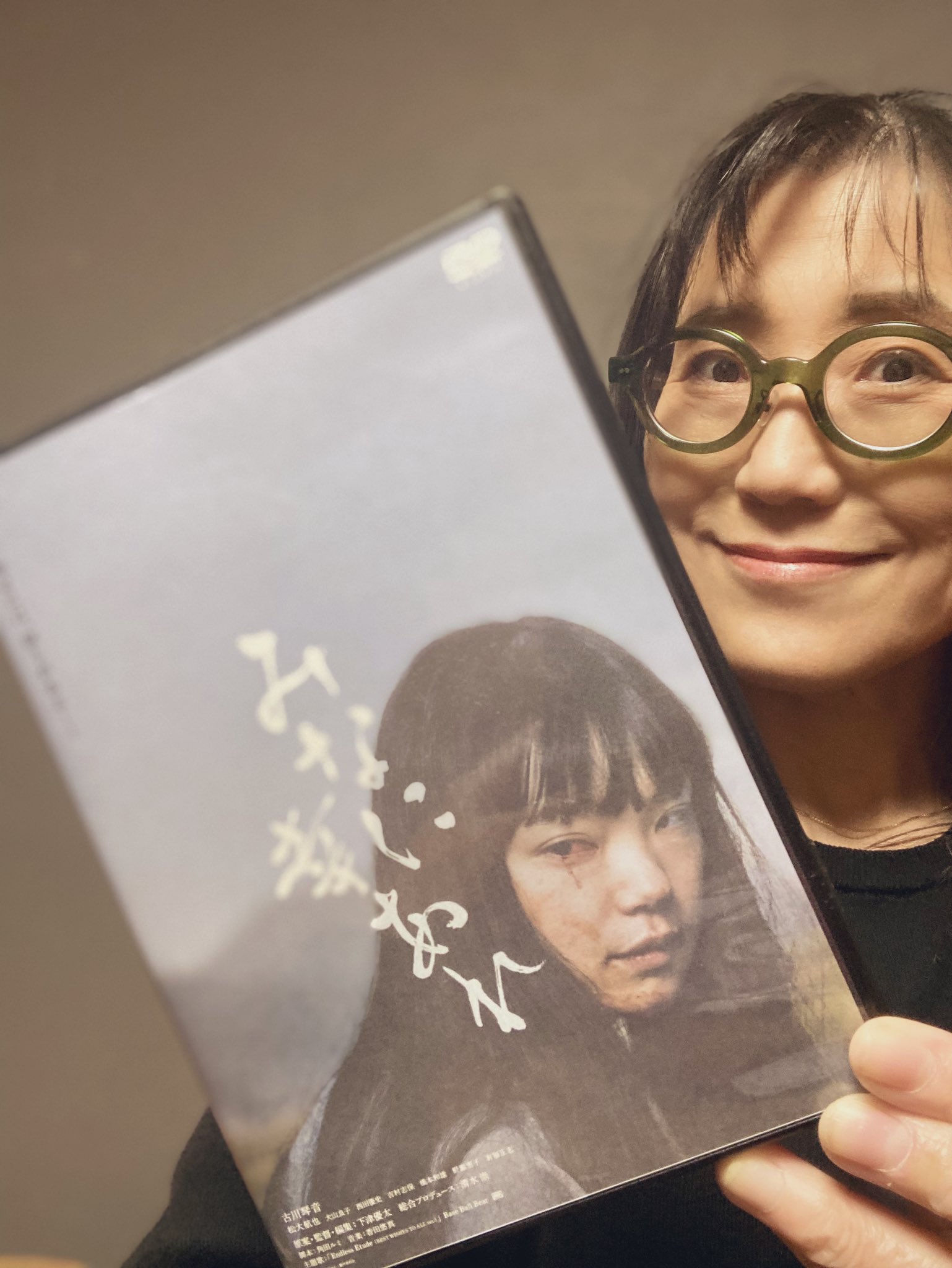 【アン】【美品・50% off】加齢黄斑変性 第2版 吉村長久 Amazon.co.jp: 加齢黄斑変性 第2版 : 吉村 長久: 本