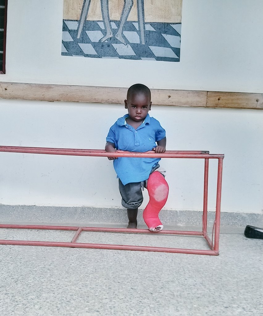 RuharoHospital's tweet photo. #Roadtoinclusion
Born with clubfoot, Joseph is progressing  well on the inclusive interventions provided by @OURSProgram  and partners. Joseph's mother: "I feel so  happy about my son's progress"
@cbmDeutschland @miraclefeet @corsuhospital @lilianefonds @NDYOWAAWE @AnkoleDiocese https://t.co/10ias86z2f