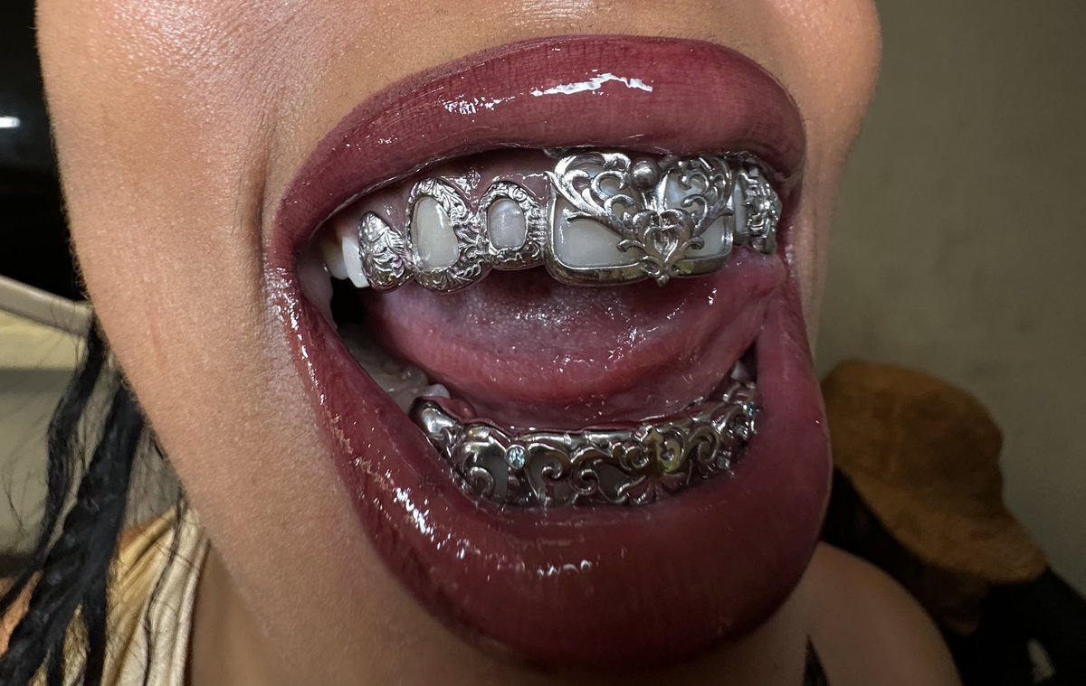 faithharperrr's tweet photo. Grills by Dusaint Duvel https://t.co/OIwAkr5mMF