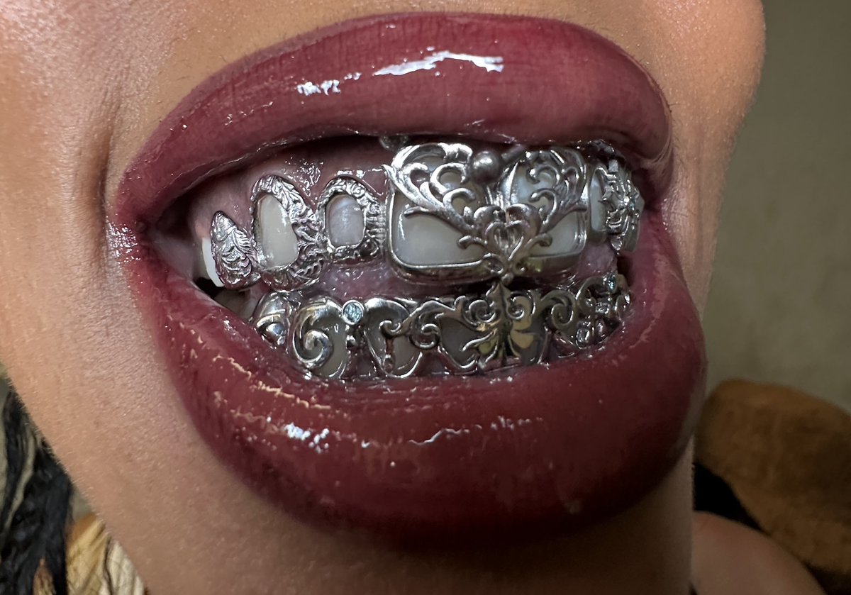 faithharperrr's tweet photo. Grills by Dusaint Duvel https://t.co/OIwAkr5mMF