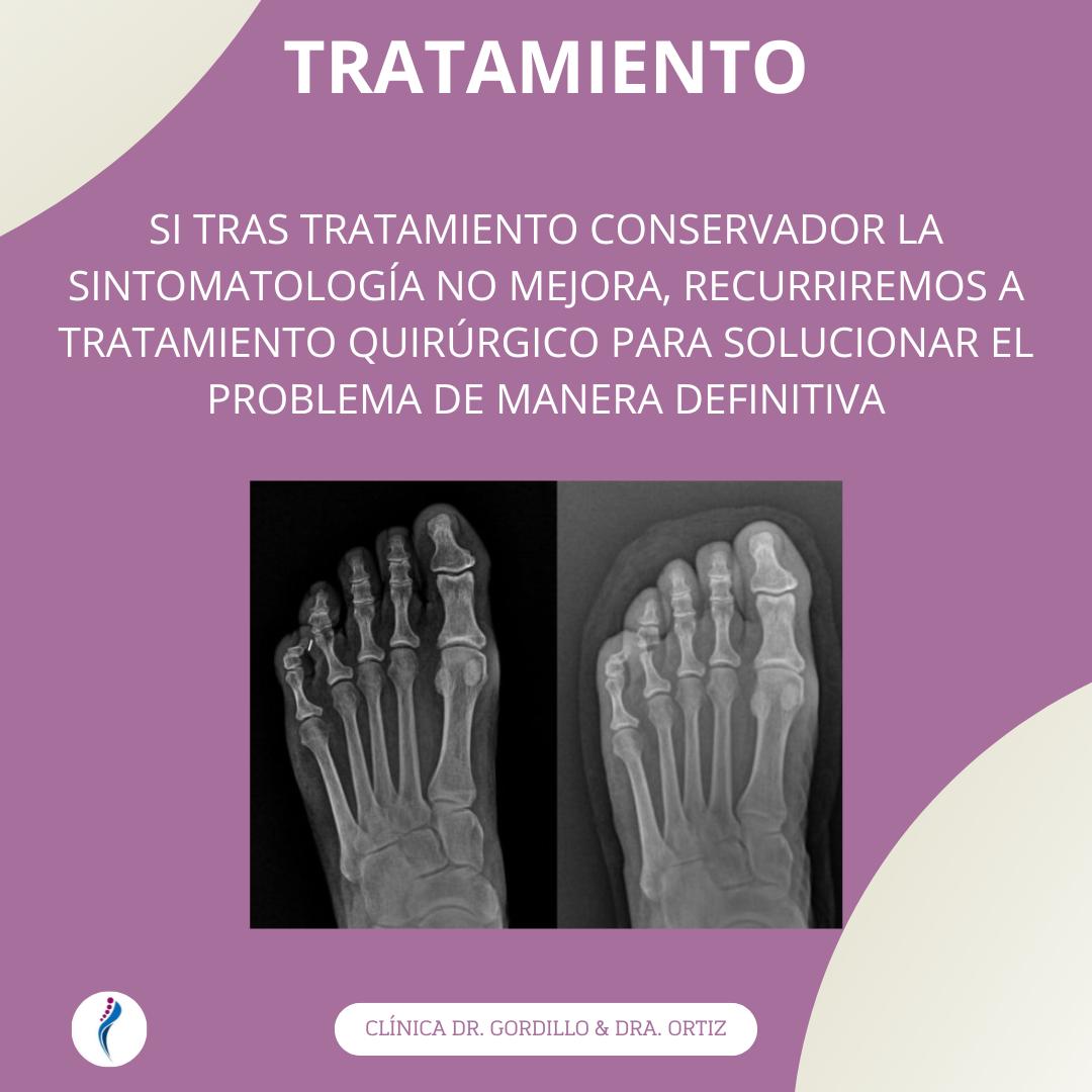 DoctoresDelPie's tweet photo. 🦶 https://t.co/qhkhVTNa3a