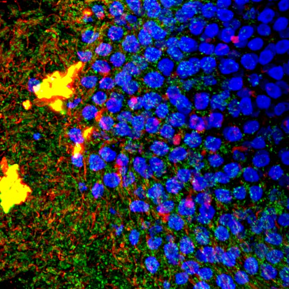 SIBPA (SocietàItalianaBiofisicaPuraApplicata) (@sibpa_) on Twitter photo Mostra scientifica "POP Microscopy", un viaggio dai laboratori alla pop art!
La mostra a cura di Claudia Diaspro e Alberto Diaspro con il supporto tecnico di paolo Bianchini è in esposizione permanente al Nikon Imaging Center dell'IIT di Genova <a href="/IITalk/">IIT</a> <a href="/DiasproLab/">Diaspro Lab</a> <a href="/gecamcom/">Camera di Commercio Genova</a> Mostra scientifica "POP Microscopy", un viaggio dai laboratori alla pop art!
La mostra a cura di Claudia Diaspro e Alberto Diaspro con il supporto tecnico di paolo Bianchini è in esposizione permanente al Nikon Imaging Center dell'IIT di Genova <a href="/IITalk/">IIT</a> <a href="/DiasproLab/">Diaspro Lab</a> <a href="/gecamcom/">Camera di Commercio Genova</a>