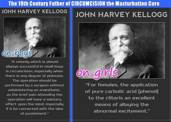 BanTheSnip's tweet photo. @reecebrah This is pure #CutCope.

Contrary to popular belief, #circumcised men have: 
-Less sensitivity
-Higher ED risk
-Less natural defense against STIs
-Higher UTI risk
-Risk of meatal stenosis
-Less relationship satisfaction
-Less ability to make a woman orgasm

#i2
#MGM
#BornPerfect https://t.co/rzxvYbqBkk