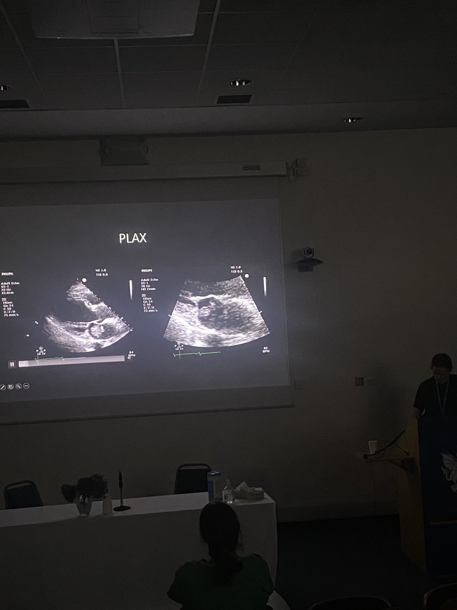 @ICUTallaght University Hospital (@icutallaght) on Twitter photo Congrats to one of our fabulous Consultants Dr. Aoife Doolan who gave a masterclass on cardiac masses in transthoracic echoc at todays <a href="/TUH_Tallaght/">Tallaght University Hospital (TUH)</a> Grand Rounds 👑
We are lucky to have Aoife and her expertise on our critical care team! Congrats to one of our fabulous Consultants Dr. Aoife Doolan who gave a masterclass on cardiac masses in transthoracic echoc at todays <a href="/TUH_Tallaght/">Tallaght University Hospital (TUH)</a> Grand Rounds 👑
We are lucky to have Aoife and her expertise on our critical care team!