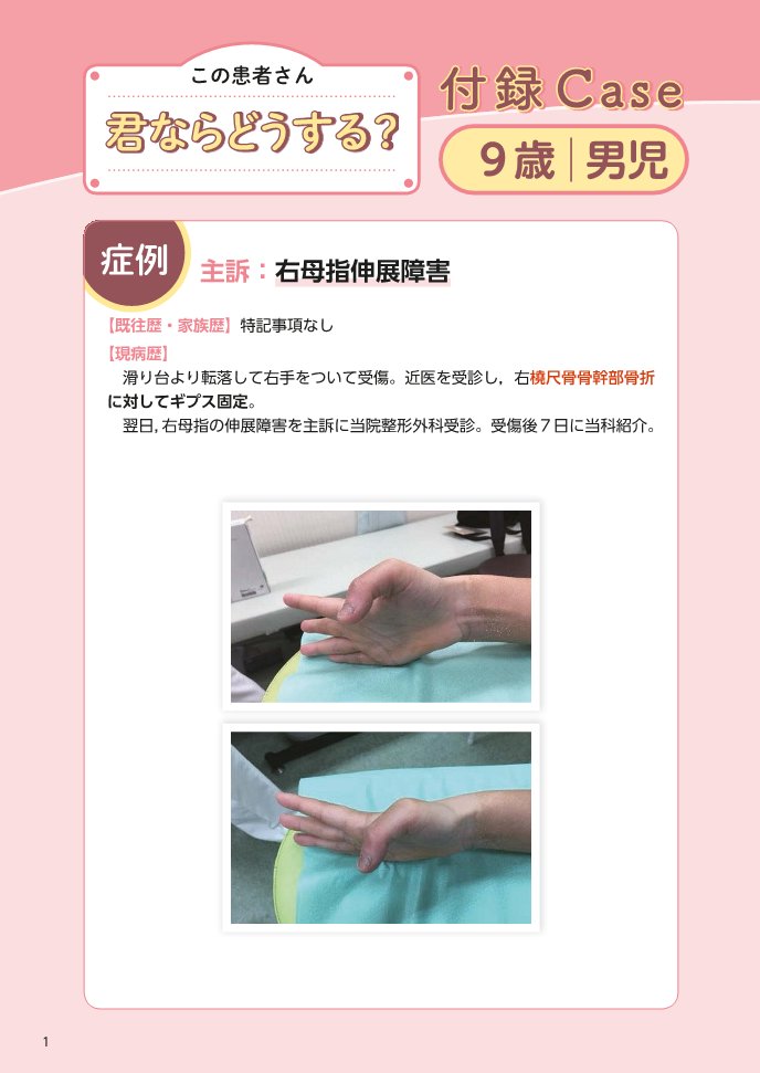 体験する手外科第3巻-先天異常・小児疾患編- 裁断済み 体験する手外科 第3巻 先天異常・小児疾患編 (第3巻) | 鳥谷部