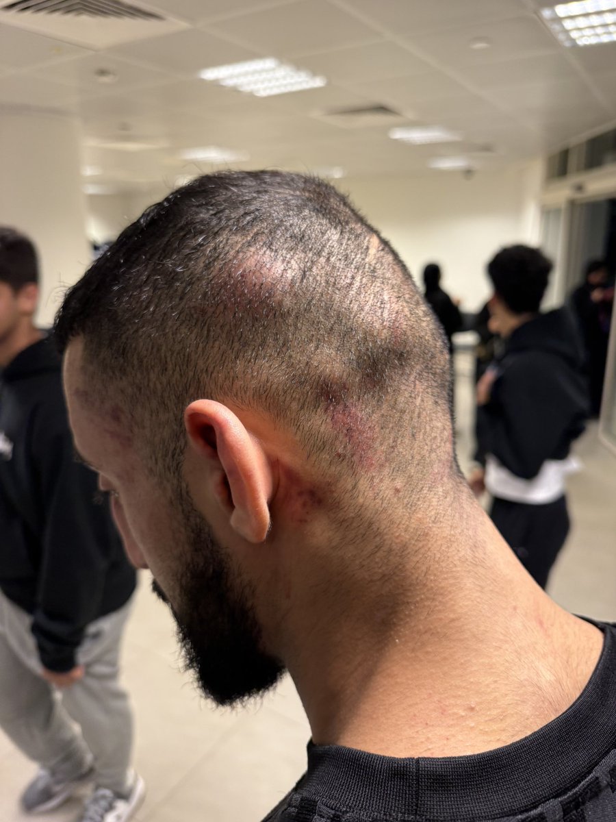 Back of my head took a beating