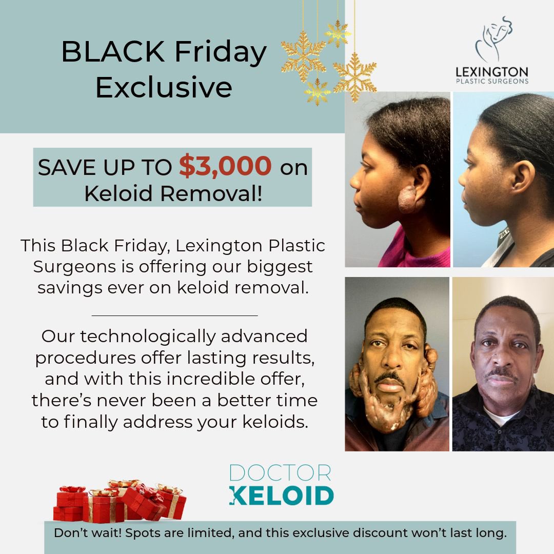 #BlackFriday exclusive ✅