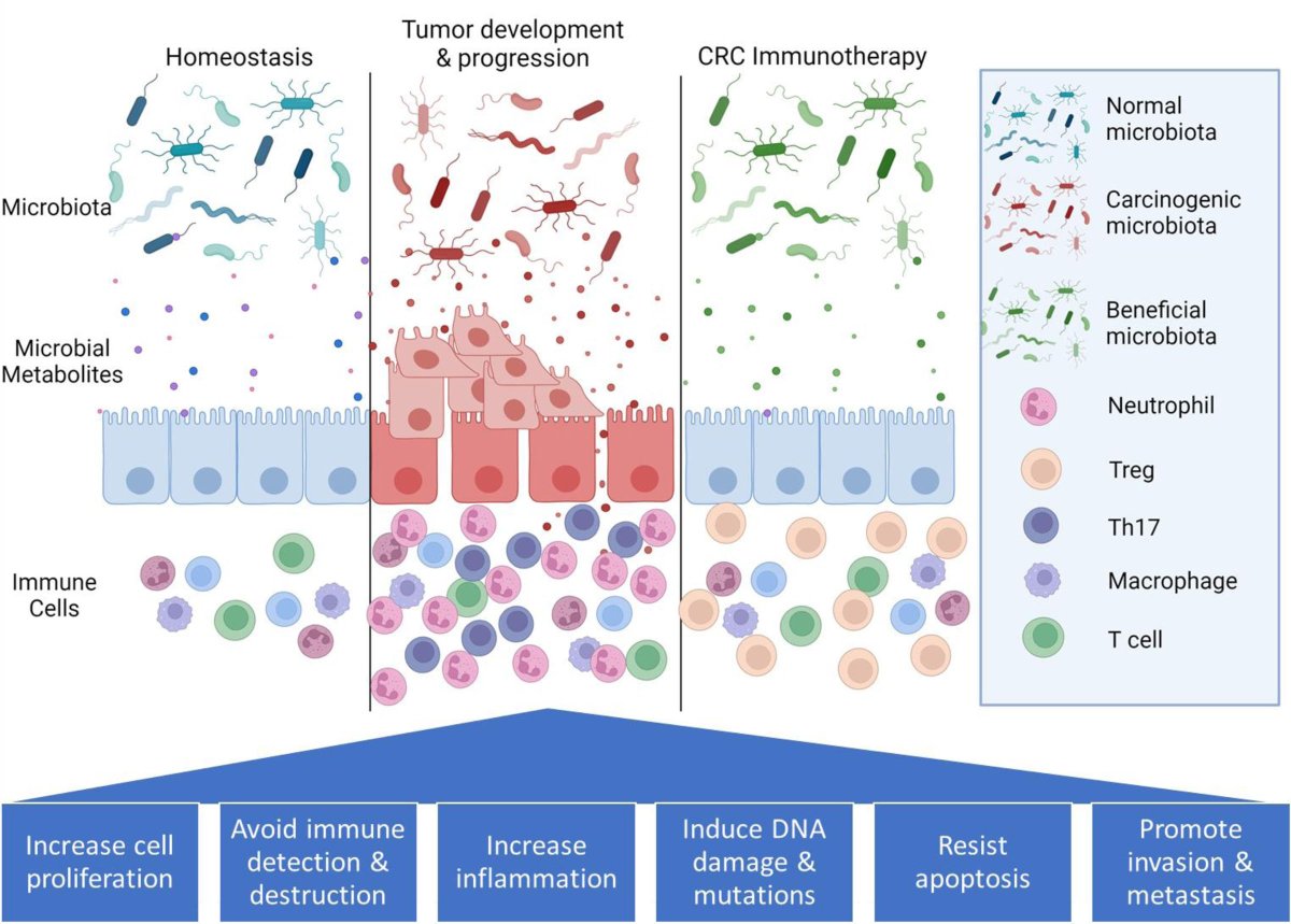 Immunometaboli2's tweet image. Review "Impact of gut microbiota and its metabolites on immunometabolism in colorectal cancer" By Professor Ashfaqul Alam et al. from University of Kentucky journals.lww.com/immunometaboli…