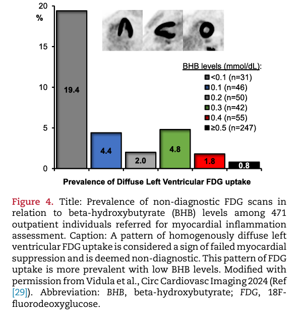 Journal of Nuclear Cardiology (@jncjournal) on Twitter photo Learn about the most effective interventions to achieve adequate suppression of physiologic myocardial FDG uptake before inflammation/inflammatory imaging. <a href="/senthil_selv/">Senthil Selvaraj, MD, MS, MA</a> @dukeheartcenter <a href="/pacoebravo/">Paco E. Bravo, MD</a> <a href="/PennCardiology/">Penn Cardiology</a>
Read now👉bit.ly/3OwKOsM
#CVNuc Learn about the most effective interventions to achieve adequate suppression of physiologic myocardial FDG uptake before inflammation/inflammatory imaging. <a href="/senthil_selv/">Senthil Selvaraj, MD, MS, MA</a> @dukeheartcenter <a href="/pacoebravo/">Paco E. Bravo, MD</a> <a href="/PennCardiology/">Penn Cardiology</a>
Read now👉bit.ly/3OwKOsM
#CVNuc