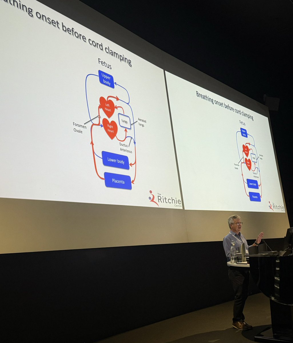 Rosemarie Boland (@roseandtoby) on Twitter photo Fetal physiology 101. No matters how many times I hear Stuart Hooper from <a href="/RitchieCentre/">The Ritchie Centre</a> explain changes during transition with physiological based cord clamping v time based cord clamping - I learn something new every time.
#CoolTopics2024 #CoolTopics24 Fetal physiology 101. No matters how many times I hear Stuart Hooper from <a href="/RitchieCentre/">The Ritchie Centre</a> explain changes during transition with physiological based cord clamping v time based cord clamping - I learn something new every time.
#CoolTopics2024 #CoolTopics24