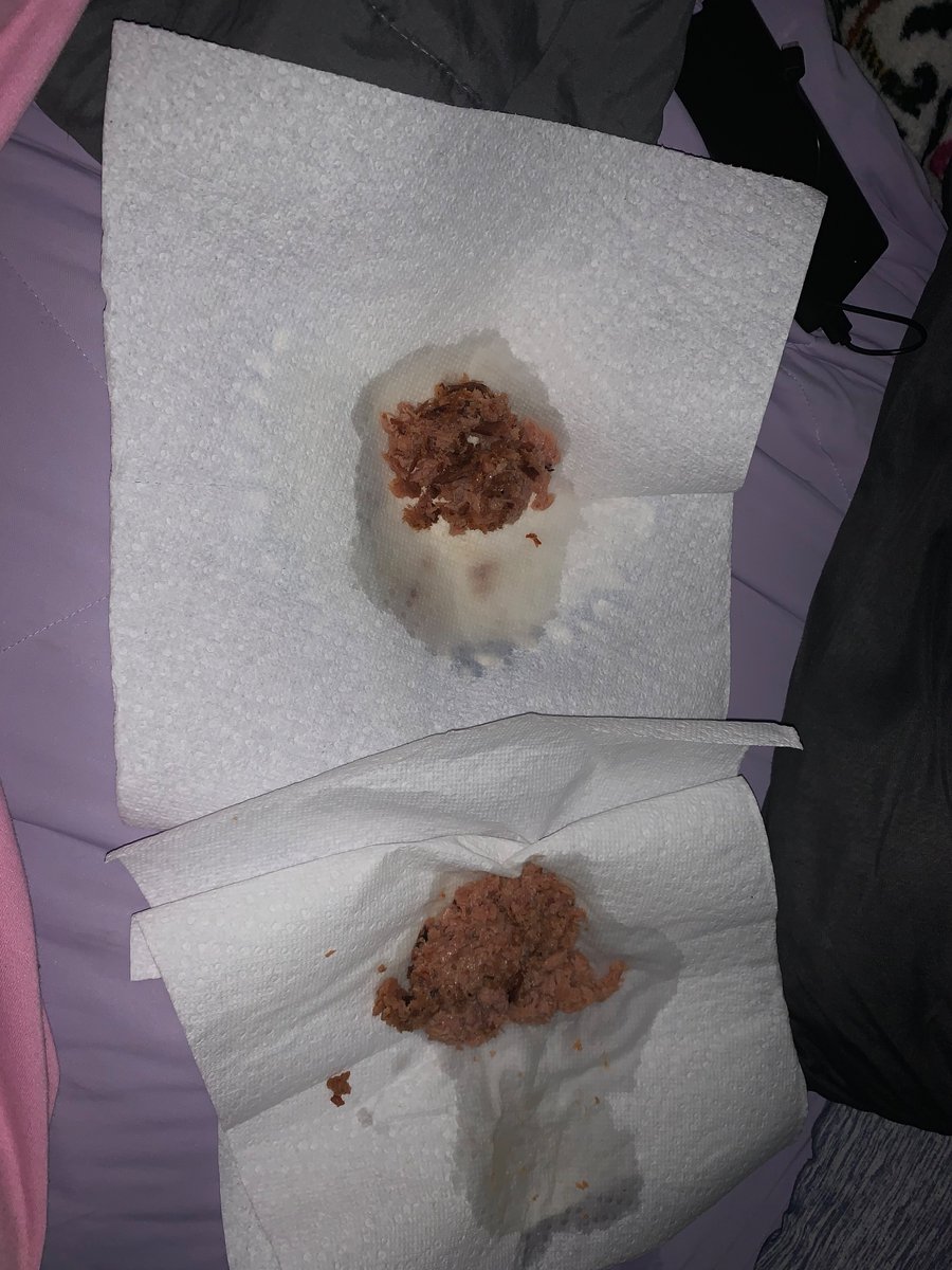 cameronmikew's tweet photo. to the edtwt girlies who also got forced to eat today and also purged it; here's the before and after of my c/s sesh https://t.co/UfCDeb8XcX