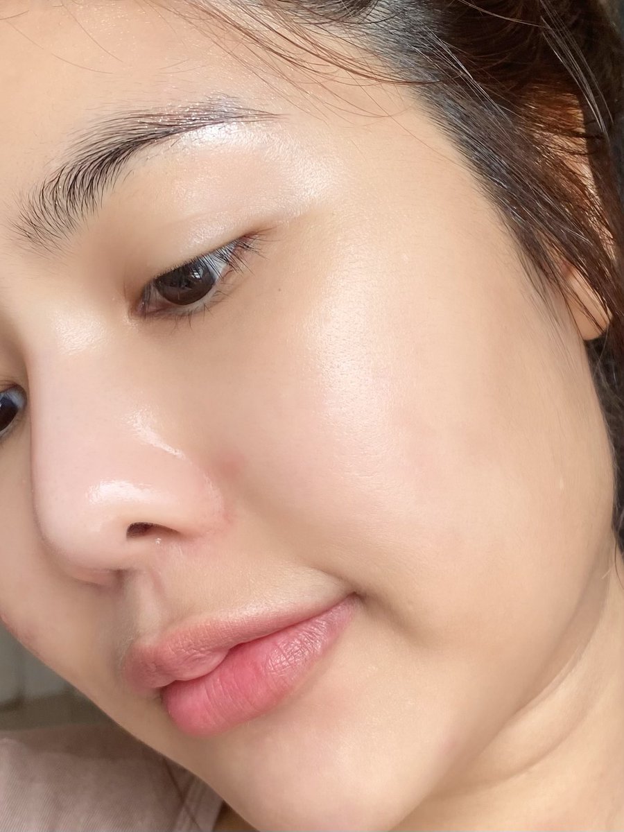 จะบอกว่าใช้ JUV Skin Barrier Cica Ampoule ขึ้นขวดที่ 2 แล้ววว ชอบมาก <3 ใครที่ผิวแห้งกร้าน ผิวอักเสบบ่อยและสิวขึ้นง่ายคือควรมี น้องช่วยได้เยอะพูดเลย มีส่วนผสมจากธรรมชาติอย่าง Centella Asiatica ที่ช่วยลดการอักเสบและปลอบประโลมผิวไปในตัว ที่เริ่ดอีกอย่างหนึ่งคือมี EPS Seaglow ที่จะช่วยดูแลผิวให้ดูขาวอมชมพูแบบ Natural Rosy Tone ใช้แล้วผิวเนียนนุ่ม ชุ่มชื้น อิ่มน้ำขั้นสุด แถมใช้ระยะยังช่วยเสริมเกราะป้องกันผิวให้แข็งแรงด้วยนะ 1000/10