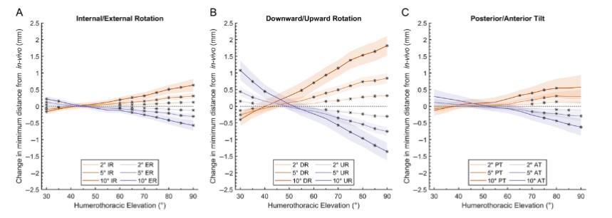New research suggests that changing scapular orientation significantly impacts measures of rotator cuff impingement and increasing scapular upward rotation may increase impingement-free range of motion.
Read more here: doi.org/10.1123/jab.20…