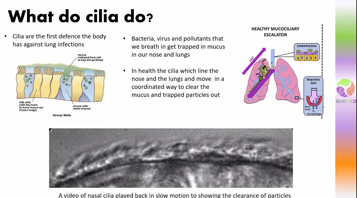Ciliopathy Alliance (@ciliaalliance) on Twitter photo Great clear information from <a href="/Shoemelia/">Amelia Shoemark</a> for <a href="/beatpcd/">BEAT-PCD (ERS CRC)</a> patient meeting. #cilia #pcd #raredisease Great clear information from <a href="/Shoemelia/">Amelia Shoemark</a> for <a href="/beatpcd/">BEAT-PCD (ERS CRC)</a> patient meeting. #cilia #pcd #raredisease