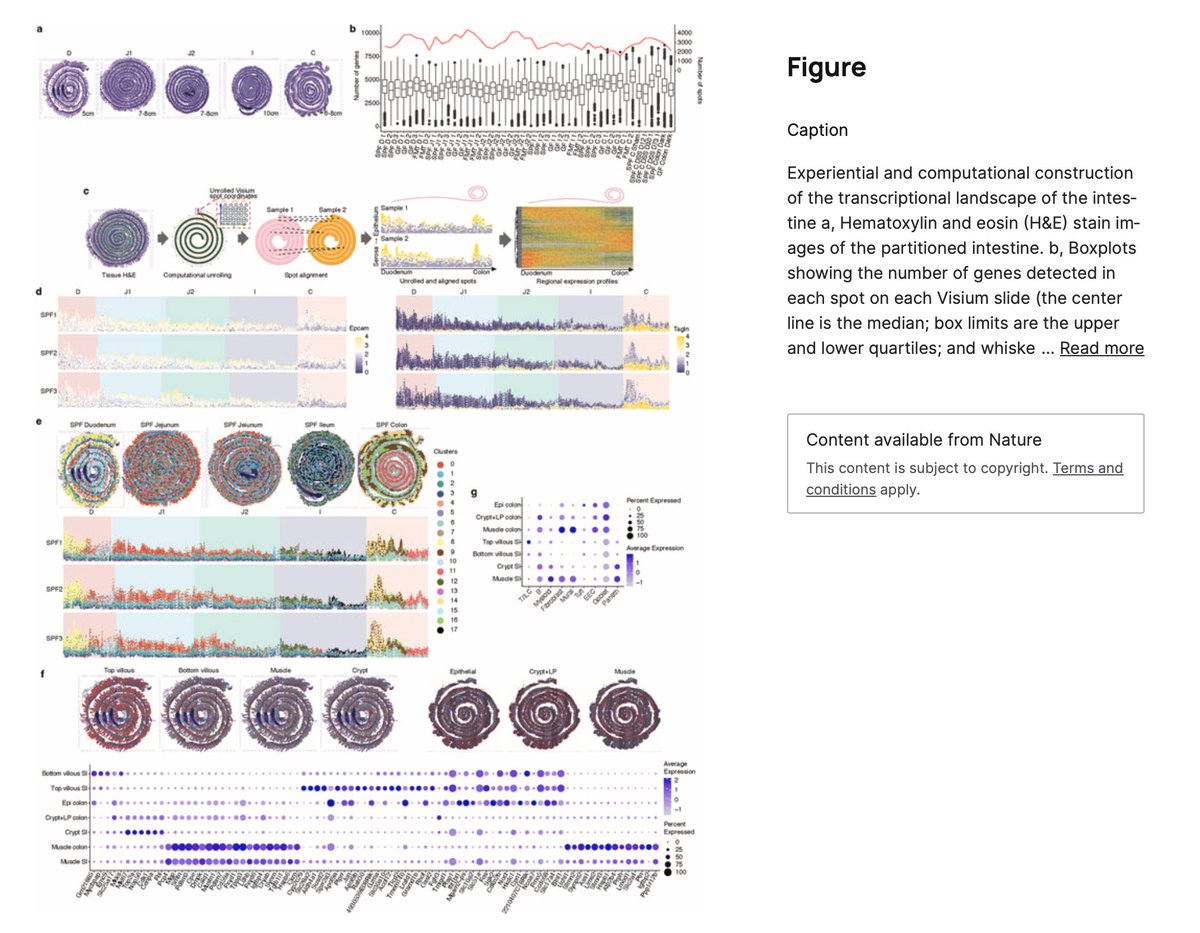 Dominik Bettenworth (@bettenworthdb) on Twitter photo Spatially restricted immune and microbiota-driven adaptation of the gut <a href="/NaturePortfolio/">Nature Portfolio</a> #IBD
pubmed.ncbi.nlm.nih.gov/39567686/
<a href="/IBD_FloMD/">Florian Rieder</a> <a href="/Y_ECCO_IBD/">Y-ECCO</a> <a href="/DignassAxel/">Axel Dignass</a> <a href="/RajaAtreya/">Raja Atreya</a> <a href="/fgomollon/">Fernando Gomollón</a> <a href="/bverstockt/">Bram Verstockt</a> <a href="/IBD_MB/">Tim Raine</a> <a href="/I_Blumenstein/">Irina Blumenstein</a> <a href="/FernandoMagro6/">Fernando Magro</a> <a href="/alearmuzzi/">alessandro armuzzi</a> <a href="/IBD_JohnD/">John Ding MD PhD</a> <a href="/vipuljairath/">Vipul Jairath MBChB DPhil</a> <a href="/RPanaccione/">Remo Panaccione, MD, FRCPC</a> Spatially restricted immune and microbiota-driven adaptation of the gut <a href="/NaturePortfolio/">Nature Portfolio</a> #IBD
pubmed.ncbi.nlm.nih.gov/39567686/
<a href="/IBD_FloMD/">Florian Rieder</a> <a href="/Y_ECCO_IBD/">Y-ECCO</a> <a href="/DignassAxel/">Axel Dignass</a> <a href="/RajaAtreya/">Raja Atreya</a> <a href="/fgomollon/">Fernando Gomollón</a> <a href="/bverstockt/">Bram Verstockt</a> <a href="/IBD_MB/">Tim Raine</a> <a href="/I_Blumenstein/">Irina Blumenstein</a> <a href="/FernandoMagro6/">Fernando Magro</a> <a href="/alearmuzzi/">alessandro armuzzi</a> <a href="/IBD_JohnD/">John Ding MD PhD</a> <a href="/vipuljairath/">Vipul Jairath MBChB DPhil</a> <a href="/RPanaccione/">Remo Panaccione, MD, FRCPC</a>
