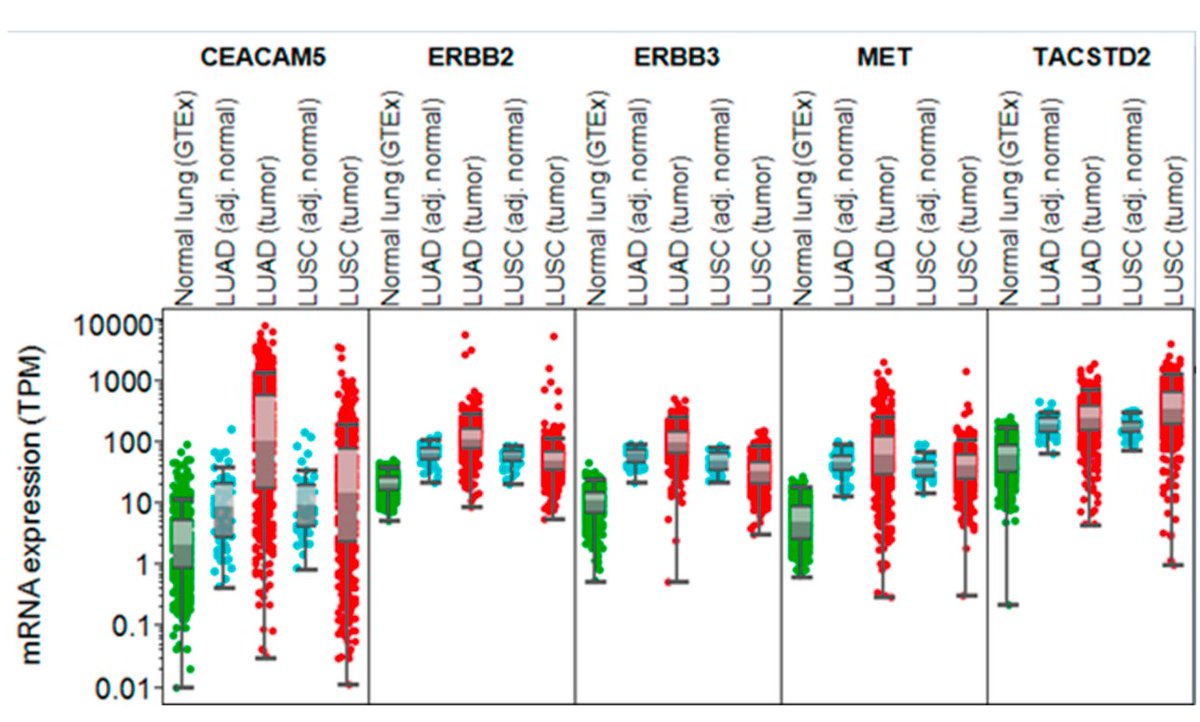 Vivek Subbiah, MD (@viveksubbiah) on Twitter photo ⭐️Association of Antibody–Drug Conjugate (ADC) Target Expression and Interstitial Lung Disease (ILD) in Non-Small-Cell Lung Cancer (NSCLC): Association or Causation or Neither? Nice work spearheaded by <a href="/ADesaiMD/">Aakash Desai, MD, MPH, FASCO</a> <a href="/peters_solange/">Solange Peters</a> <a href="/Sinchita_Roy/">Sinchita Roy MD PhD</a> <a href="/ajaysheshadri/">Ajay Sheshadri</a> <a href="/OncoAlert/">OncoAlert</a> #ADC ⭐️Association of Antibody–Drug Conjugate (ADC) Target Expression and Interstitial Lung Disease (ILD) in Non-Small-Cell Lung Cancer (NSCLC): Association or Causation or Neither? Nice work spearheaded by <a href="/ADesaiMD/">Aakash Desai, MD, MPH, FASCO</a> <a href="/peters_solange/">Solange Peters</a> <a href="/Sinchita_Roy/">Sinchita Roy MD PhD</a> <a href="/ajaysheshadri/">Ajay Sheshadri</a> <a href="/OncoAlert/">OncoAlert</a> #ADC