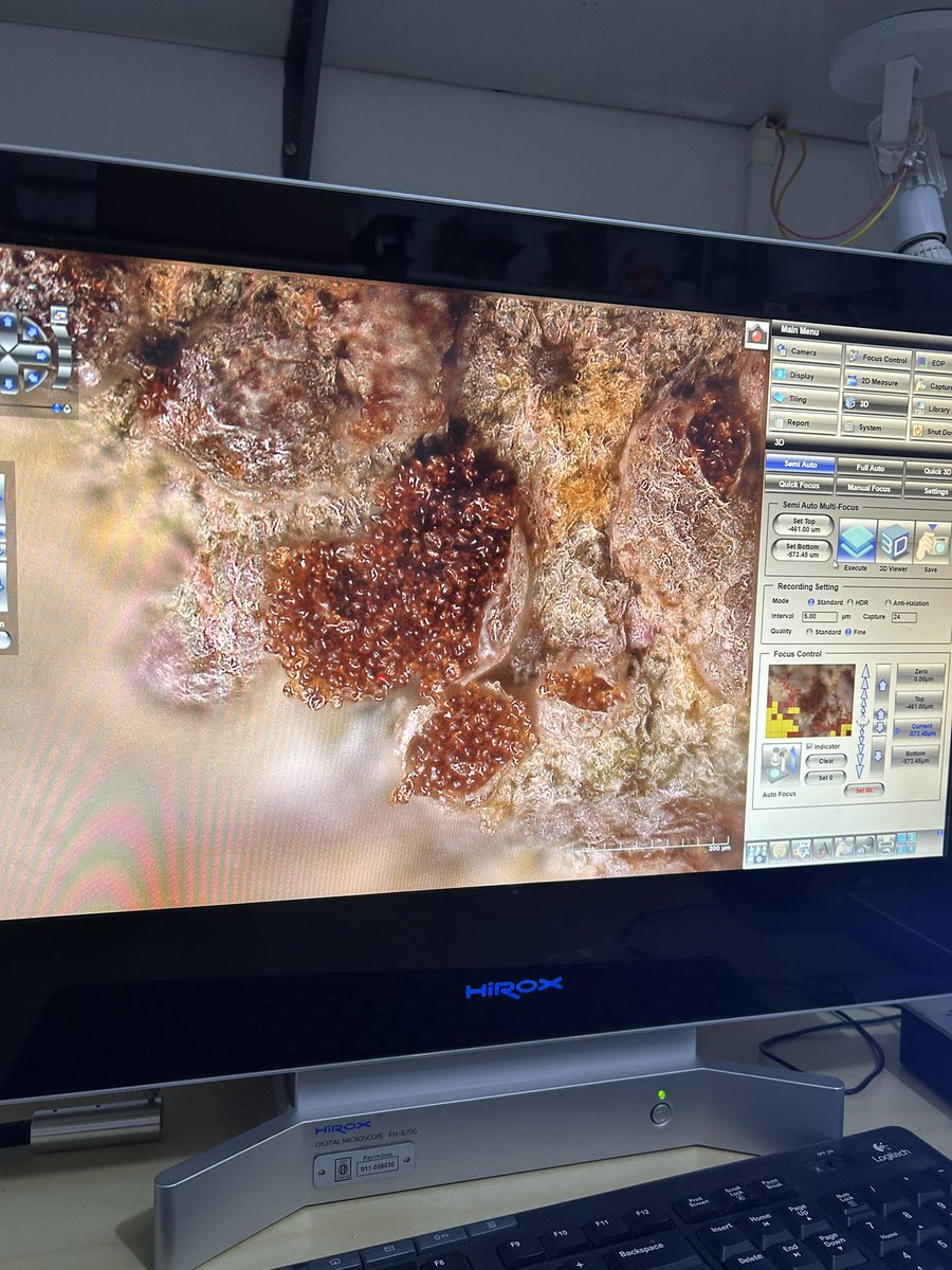 #Myrtle #rust teliospores photograph with #Hirox 3D