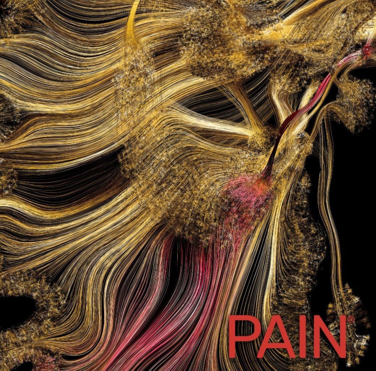 ¡Impresionante portada de #PAIN este mes con una obra de Greg Dunn! 🎨 
El núcleo accumbens, región cerebral donde Randal Serafini et al. sobreexpresaron MEF2C para aliviar el dolor y la ansiedad, es el protagonista. 🧠
Accede para leer: 
journals.lww.com/pain/Pages/cur…
#ciencia