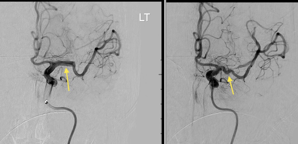Charles Beaman tweet media