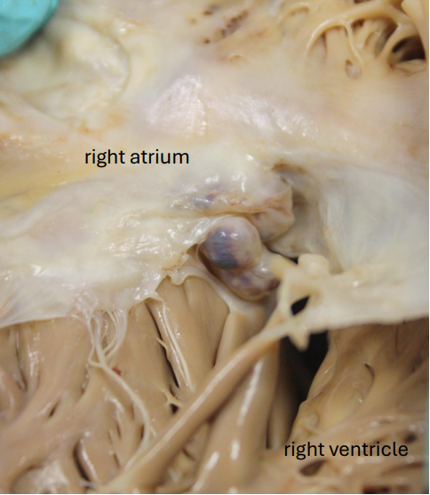 CRY Cardiac Path tweet media