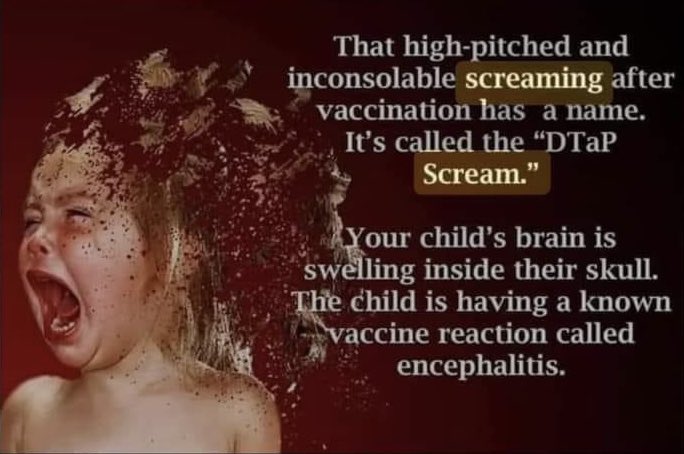 My doctor told me the brain swelling usually subsides after a few hours.