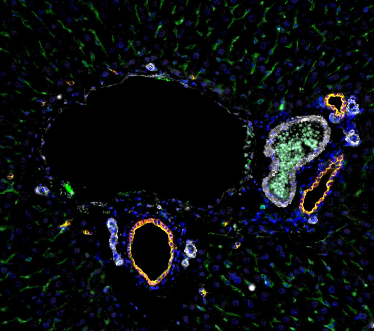 Jan Mašek (@janmaseklab) on Twitter photo Grateful for the #GAČR funding we received to study how mesenchyme contributes to liver development. 🙏 to ourl liver team <a href="/dfvoliveira/">Daniel V. Oliveira</a>, <a href="/anna_frontino94/">Anna Maria Frontino</a>, and <a href="/ETrampotova/">Eliška Trampotová</a> who worked so hard on the preliminary data. Grateful for the #GAČR funding we received to study how mesenchyme contributes to liver development. 🙏 to ourl liver team <a href="/dfvoliveira/">Daniel V. Oliveira</a>, <a href="/anna_frontino94/">Anna Maria Frontino</a>, and <a href="/ETrampotova/">Eliška Trampotová</a> who worked so hard on the preliminary data.