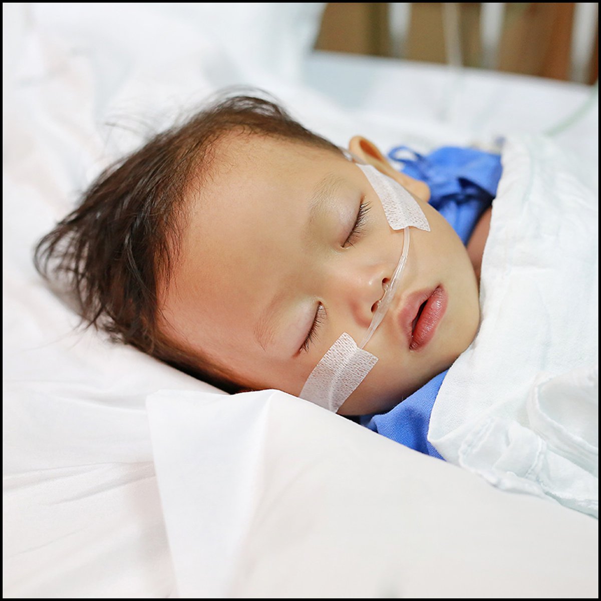 The Trial Remifentanil DEXmedetomidine (TREX) trial aimed to determine whether low-dose sevoflurane/dexmedetomidine/remifentanil #anesthesia is superior to standard-dose sevoflurane anesthesia in children younger than 2 years old. Learn more: ow.ly/xeNg50Ufhpu