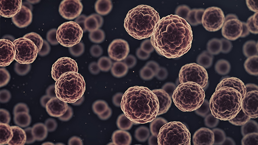 UHN Research (@uhn_research) on Twitter photo Scientists at <a href="/PMResearch_UHN/">Princess Margaret Cancer Centre Research</a> led by <a href="/MKoritzinsky/">Marianne Koritzinsky</a> and @sandyserena___have identified the enzyme ADO as critical for cancer cell survival, making it a potential new therapeutic target.
Read more ➡️ uhnresearch.ca/news/cancer-me… Scientists at <a href="/PMResearch_UHN/">Princess Margaret Cancer Centre Research</a> led by <a href="/MKoritzinsky/">Marianne Koritzinsky</a> and @sandyserena___have identified the enzyme ADO as critical for cancer cell survival, making it a potential new therapeutic target.
Read more ➡️ uhnresearch.ca/news/cancer-me…