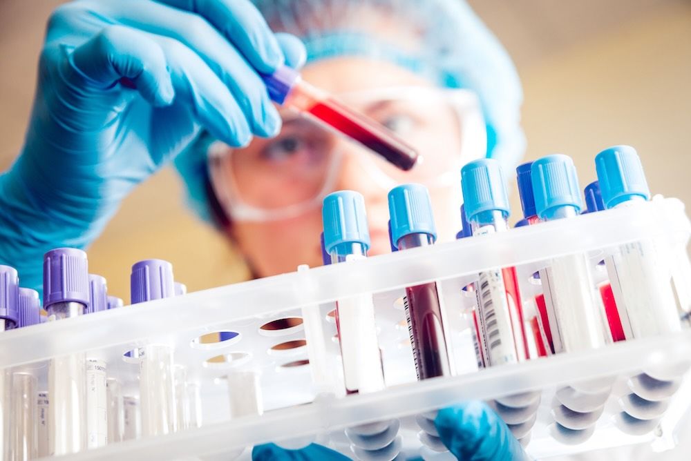 UK Dementia Research Institute (@ukdri) on Twitter photo Scientists led by <a href="/KlenermanLab/">KlenermanLab</a> have developed a new biomarker to measure brain inflammation in Alzheimer's & Parkinson's š§ š It could improve diagnostics and help test new therapies in clinical trials: š buff.ly/4i8aycL Scientists led by <a href="/KlenermanLab/">KlenermanLab</a> have developed a new biomarker to measure brain inflammation in Alzheimer's & Parkinson's š§ š It could improve diagnostics and help test new therapies in clinical trials: š buff.ly/4i8aycL