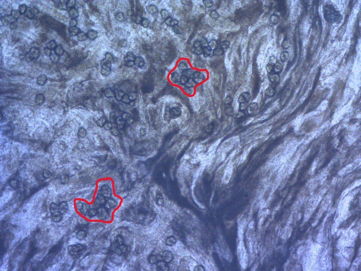 classoalcala's tweet photo. El misterioso pez graso de Tota es conocido por tener 6 a 8 anillos o capas de tejido adiposo. En su interior encontramos pequeñas células grasas (adipositos), de función desconocida. Gracias E. López (UIS), @hdagudelo. @inst_humboldt @Shoal_Org @rewild https://t.co/nXgBCPqwg8