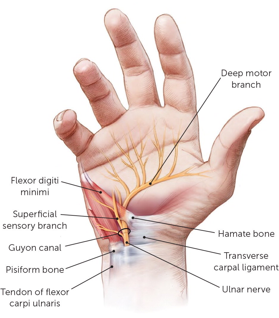 Omid_HopeUni's tweet photo. Ulnar nerve sensory and motor distributions in the hand

https://t.co/45LnJ2aSmg https://t.co/jkPzCUOs3J