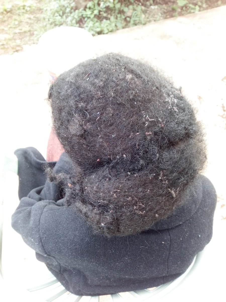 NjeriWaMigwi's tweet photo. Today we washed Njeri's hair.
Years of neglect, dirt and lice.

You can see the smile now. https://t.co/uqz93Kz2cK
