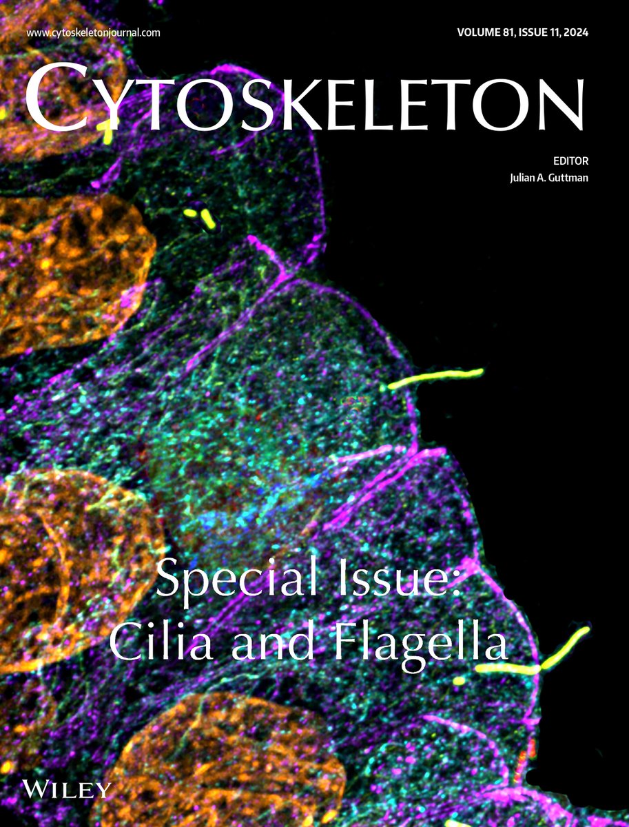 Cytoskeleton Journal (@cytoskeljournal) on Twitter photo It's #fluorescencefriday and we've got a wonderful image for you. The inside front cover of the #cilia and #flagella #special issue. Enjoy! onlinelibrary.wiley.com/toc/19493592/2β¦ <a href="/LangnerEP/">Ewa Langner</a> It's #fluorescencefriday and we've got a wonderful image for you. The inside front cover of the #cilia and #flagella #special issue. Enjoy! onlinelibrary.wiley.com/toc/19493592/2β¦ <a href="/LangnerEP/">Ewa Langner</a>