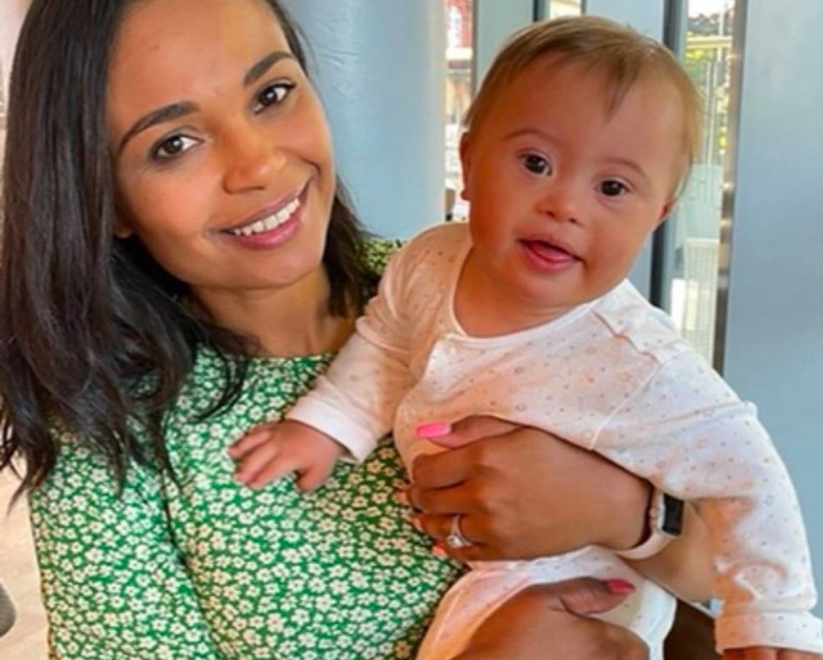 This child, with an extra chromosome, is valuable and worthy of life.