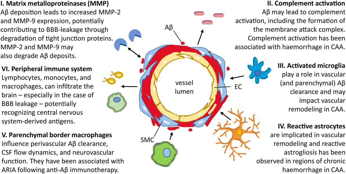 Mariel Kozberg (@marielkozberg) on Twitter photo Is neuroinflammation central to vascular damage in #CerebralAmyloidAngiopathy? Could neuroinflammation be a treatment target for #CAA? Really enjoyed writing this review with Hilde van den Brink, <a href="/SabineV159/">Sabine Voigt</a>, and @Ellis_van_Etten!
sciencedirect.com/science/articl… Is neuroinflammation central to vascular damage in #CerebralAmyloidAngiopathy? Could neuroinflammation be a treatment target for #CAA? Really enjoyed writing this review with Hilde van den Brink, <a href="/SabineV159/">Sabine Voigt</a>, and @Ellis_van_Etten!
sciencedirect.com/science/articl…