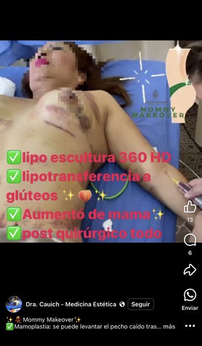 cv2367's tweet photo. @CharlatanesMed 😥😥😥😥 https://t.co/2XC2PMoWwJ