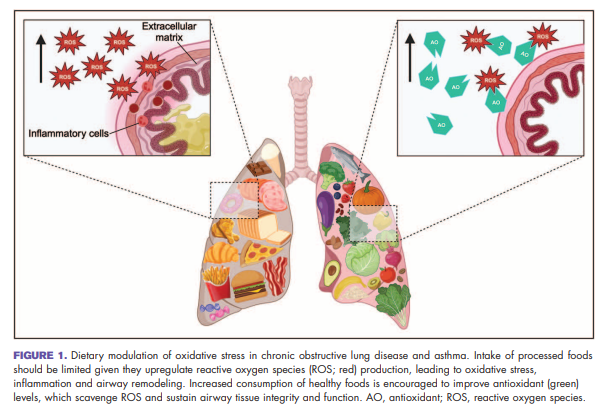 Food for thought: What should pts with #COPD or #asthma be eating on a daily basis? Processed food (no!), green veggies, legume, fruits and my favorite, beetroot juice (yes!). A short review by <a href="/motahare/">Motahareh Vameghestahbanati,MD, PhD</a> &amp; Dr. Carolyn Wang <a href="/HLIStPauls/">HLI at St Paul's</a> 
journals.lww.com/co-pulmonaryme…