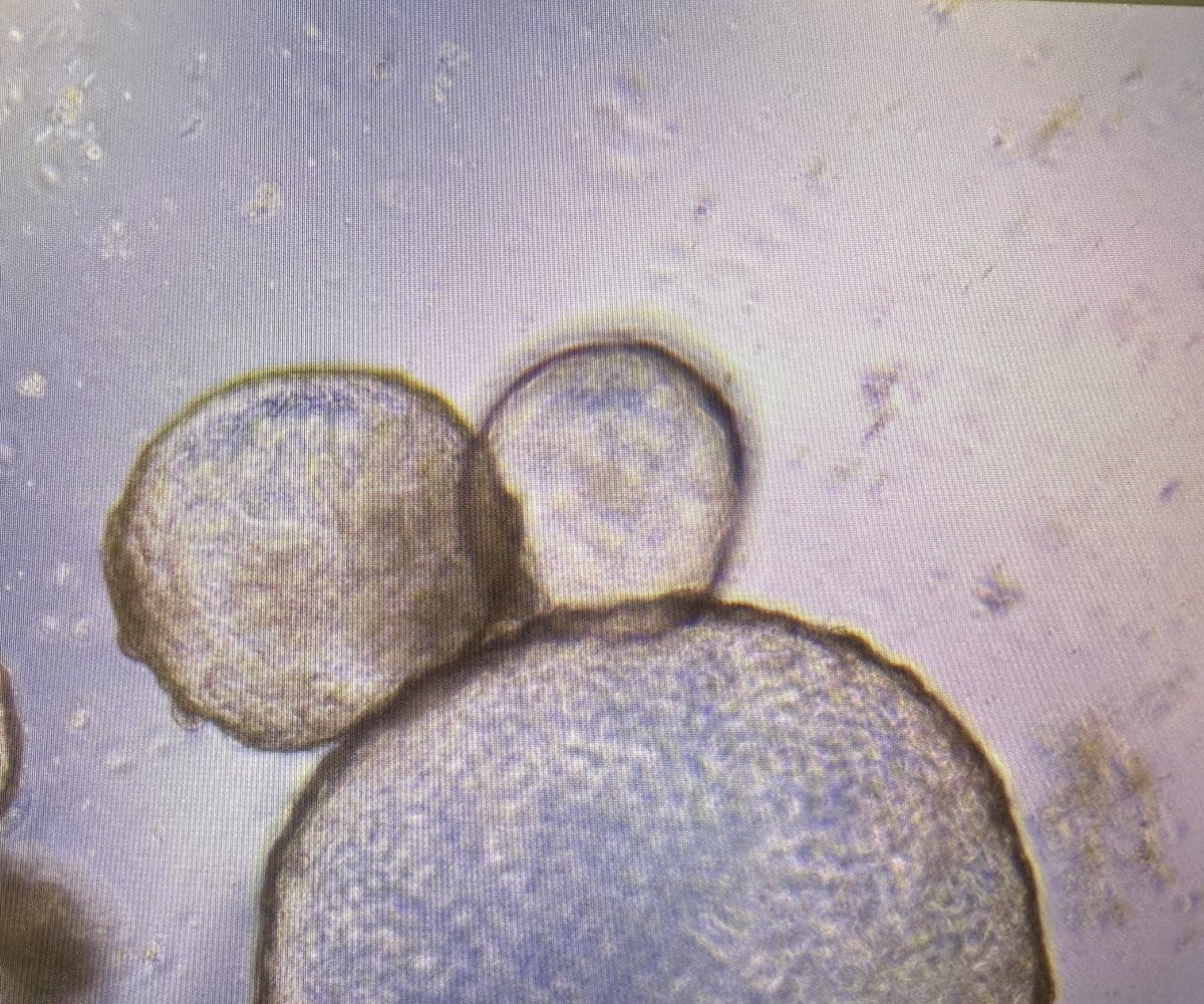 Snapped this cute picture of my alveolarspheres in culture this morning hanging out with each other. #iPSC #alveolarspheres #geneedited #stemcells #stemcellbiology #lungs