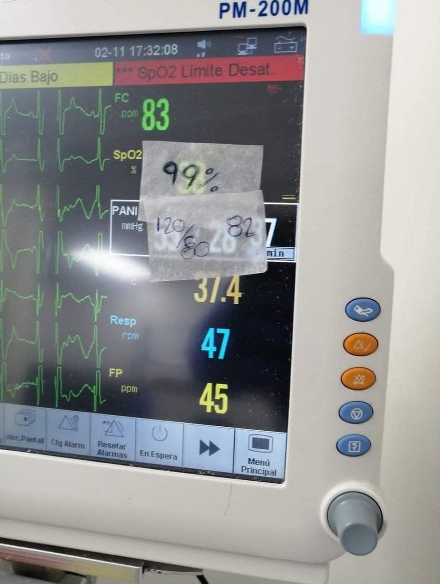 لما الحاله ت arrest و تشتغل عليها  مترجعش 
تمسك شيت التمريض تلاقيه مقفل ال vital كلها normal  لاخر الشفت 🤝😂😂