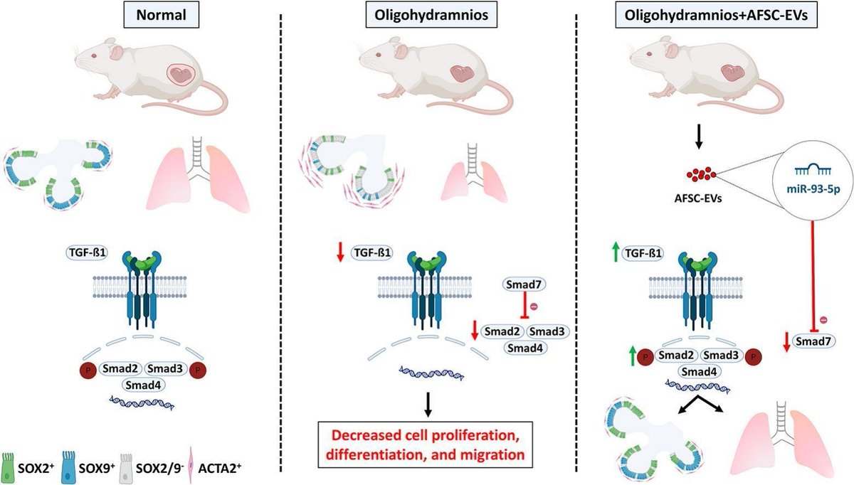 J Controlled Release (@jcrneditors) on Twitter photo Amniotic fluid stem cell extracellular vesicles promote lung development via TGF-beta modulation in a fetal rat model of oligohydramnios.
| Augusto Zani <a href="/SickKidsNews/">The Hospital for Sick Children (SickKids)</a> |
#ExtracellularVesicle #StemCell
doi.org/10.1016/j.jcon… Amniotic fluid stem cell extracellular vesicles promote lung development via TGF-beta modulation in a fetal rat model of oligohydramnios.
| Augusto Zani <a href="/SickKidsNews/">The Hospital for Sick Children (SickKids)</a> |
#ExtracellularVesicle #StemCell
doi.org/10.1016/j.jcon…