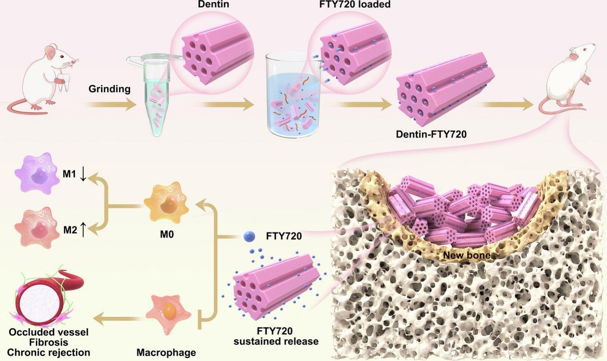 JCRnEDITORS's tweet image. Dentin tubules as a long-term sustained release carrier to accelerate bone repair by loading FTY720.
| Fujian Zhao @smu_medical |
#SustainedRelease #dentin #BoneRepair
doi.org/10.1016/j.jcon…